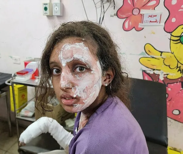 gazzede-icler-acisi-durum-tedavi-olmadigi-icin-siviller-olume-terk-edildi-defnedilemeyenlerin-bir-kismini-ise-1699822051387.jpeg Gazze'de içler acısı durum | Tedavi olmadığı için siviller ölüme terk edildi! Defnedilemeyenlerin bir kısmını ise köpekler parçaladı-4