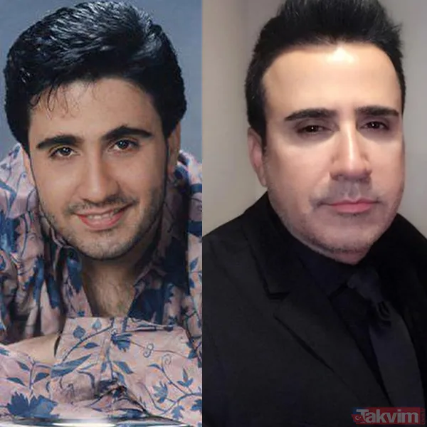 Yeşilçam’ın Sultan’ı Türkan Şoray'ın kızı Yağmur Ünal’ın son haline bakın! Botokstan konuşamadı! Gören şaştı kaldı - 8