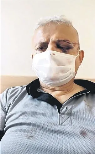 Güvenlik görevlisi 'maskeni tak' dediği kişi tarafından kör edildi!-1