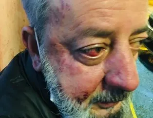 Yaşlı adamı kiracıları dövdü