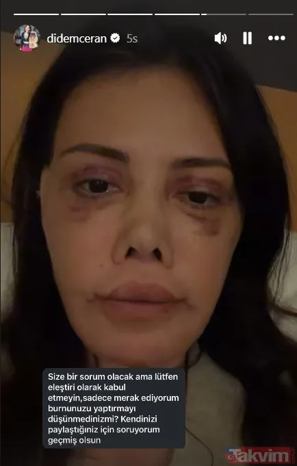 Eski Survivor yarışmacısı Didem Ceran Güney Kore'de 15 saatlik "yüz nakli" operasyonu geçirdi - 8