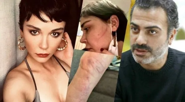 Sermiyan Midyat tarafından darbedilen Sevcan Yaşar o ses kaydını ortaya döktü! 'Çıplak görüntülerimi çekti' demişti...-11