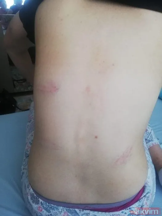 Kadınlardan kadınlara korkunç taciz ve işkence! Mağdur sayısı artıyor! "Yüzümde sigara söndürdüler" - 7