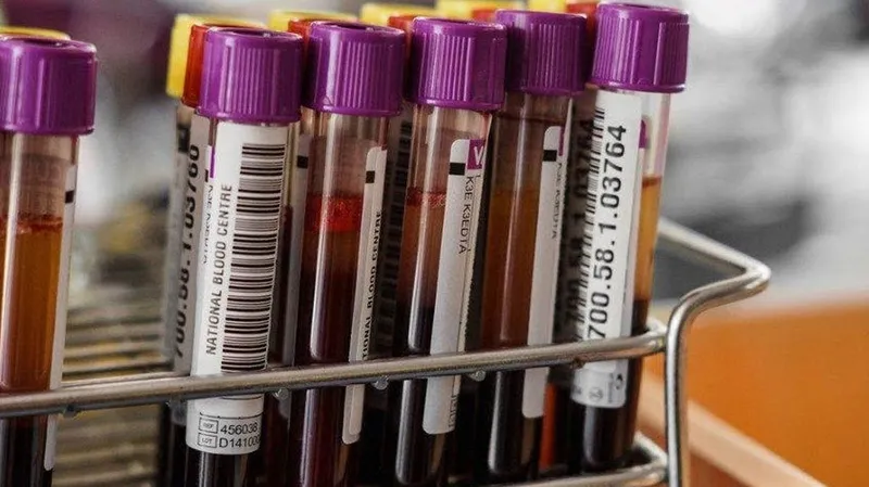 en-uzun-omurlu-kan-grubu-belli-oldu-70-yasina-kadar-hastalik-yuzu-gormuyorlar-1718890099962.jpg En uzun ömürlü kan grubu belli oldu! 70 yaşına kadar hastalık yüzü görmüyorlar-3