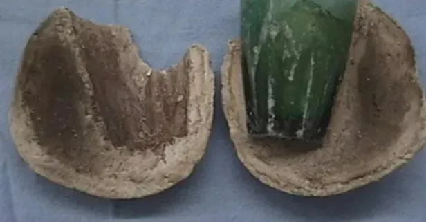 Cinsel fantezi öldürecekti! İdrar yolları enfeksiyonu için gitti mesanesinden cam bardak çıktı