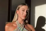 Aleyna Kalaycıoğlu'nun yıllar önceki burun estetiği doktoru tarafından yeniden paylaşıldı