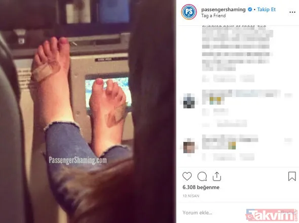 'Bu kadar da olmaz' dedirten iğrenç görüntüler! Mide bulandıran görüntüler - 22