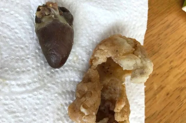 Fast-food zincirinden aldığı tavuktan çiğ kalp çıktı