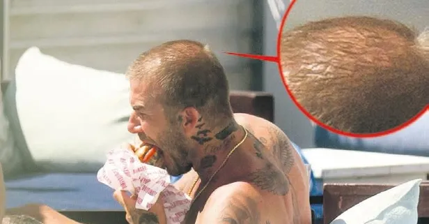 Takke düştü kel göründü