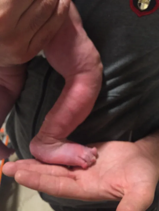 Skandal iddia! Doktorun ihmali bebeği ayağından ediyordu-1