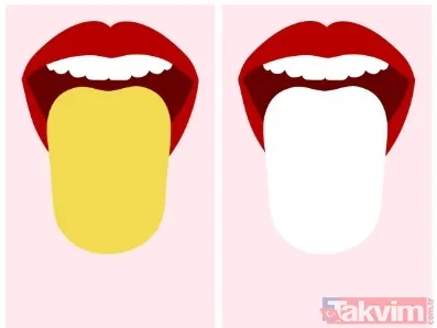 🌈 Renk Değişimleri Neleri Gösteriyor? Montana'da Diş Hekimliği Yapan Dr. Leslie Anthony'ye Göre: Kırmızı Dil: Vücutta Ateş Ya Da Hormonal Dengesizlik Olabilir...