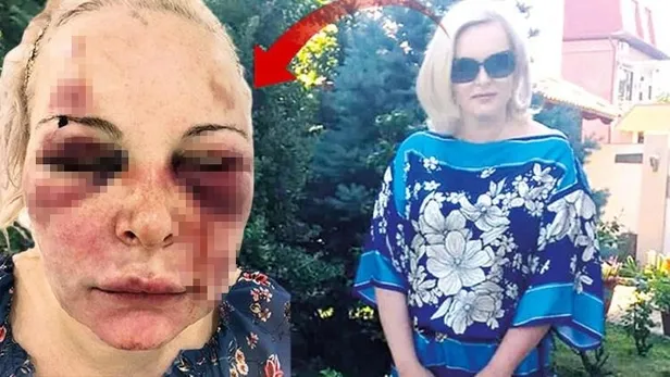 SON DAKİKA: Rus kadın otel odasında dehşeti yaşadı! "Tadı ne güzelmiş"-3