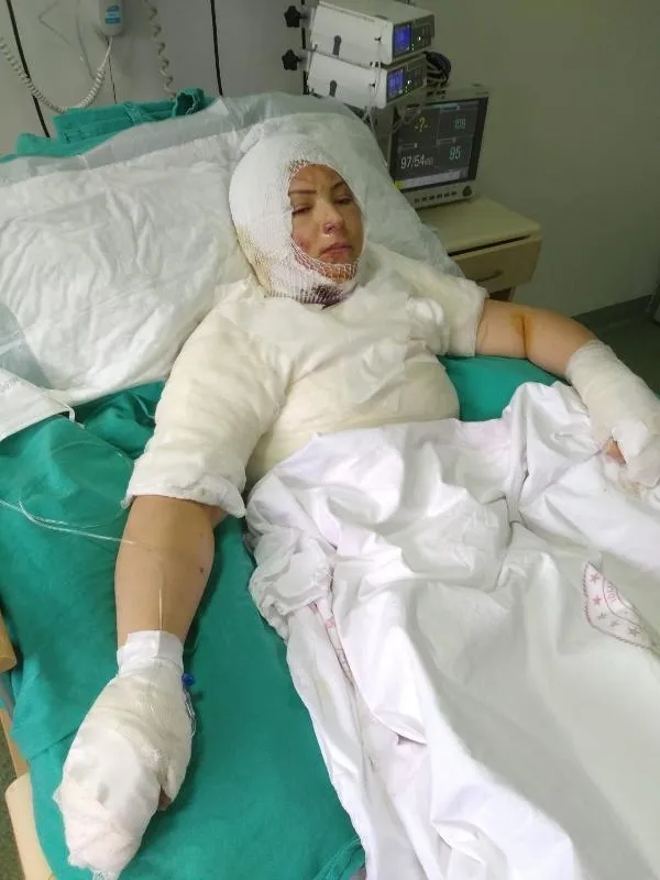 Eski eşi Elvan Sözkesen'i yanıcı maddeyle ateşe verip yanarken izledi!-6