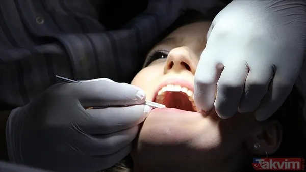 Diş fırçalamak orucu bozar mı? Diş tedavisi ve dolgu yaptırmak orucu bozar mı? - 6