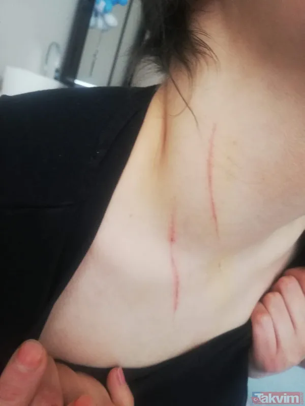 Konya'da iki kadın tarafından kaçırılıp işkence edilen Demet A dehşet anlarını anlattı! 'Evden çıkamayacağım sandım' - 4