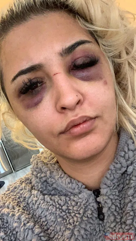 Eski sevgilisine dehşeti yaşattı: Ayrılmayı kabul etmedi 3 saat boyunca darp ederek tanınmaz hale getirdi! - 2