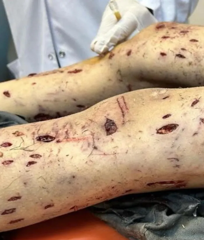 baskan-erdogandan-basibos-sokak-sorunuyla-ilgili-flas-mesaj-mutlaka-cozume-kavusturacagiz-1702127390127.jpeg Başkan Erdoğan'dan başıboş sokak sorunuyla ilgili flaş mesaj: Mutlaka çözüme kavuşturacağız-5