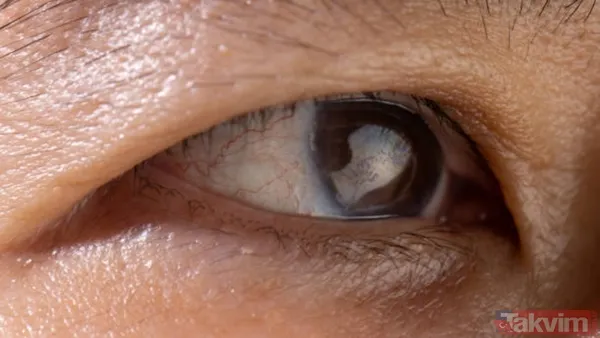 "Ya Korkuyla Yaşardım Ya Da Minnettarlıkla Dolardım. Ben Minnettarlığı Seçtim, Çünkü Kim Korku İçinde Yaşamak İster Ki?" Diyerek Hikayesini Sonlandıran Cobb,...