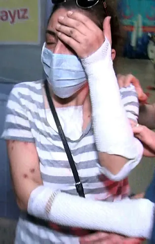 Eski erkek arkadaşının yüzüne kezzap atmıştı! Koronavirüslü çıktı