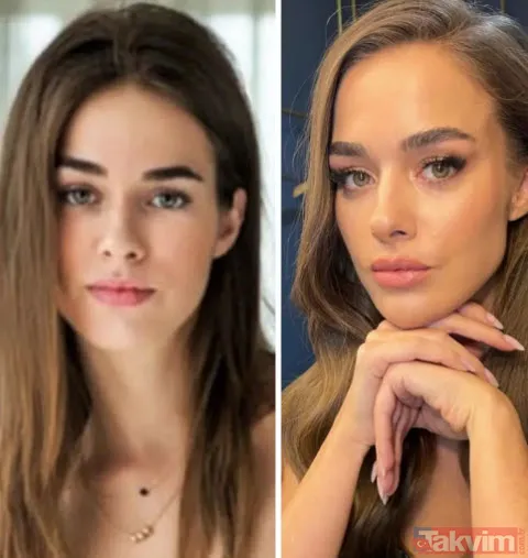 Bensu Soral "Hiç estetiğim yok kendimi güzel bulmuyorum" dedi ortalık birbirine girdi "Tabi biz de yedik" Yüzündeki değişim çok konuşulmuştu - 10