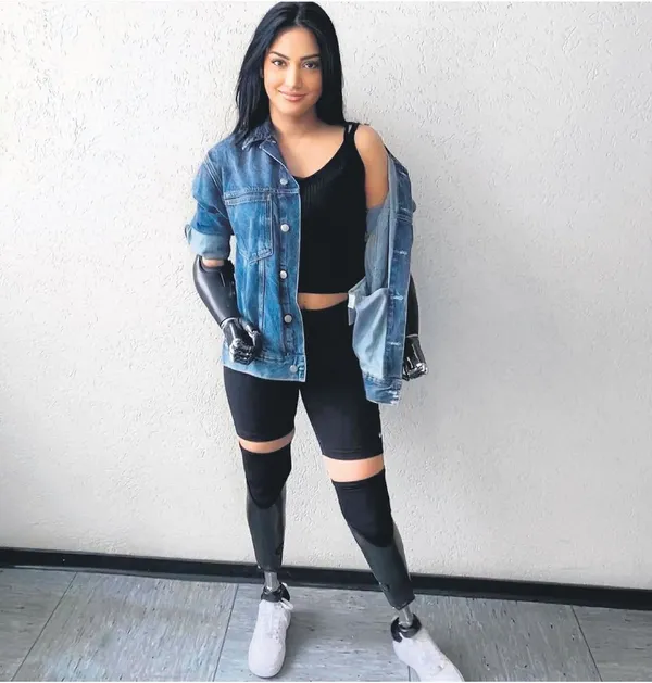 Diş teknisyeni Beyza Doğan kol ve bacaklarını kaybetti! Yeniden hayata tutundu-1