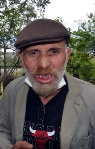 Komşu kavgası! Tiyatrocu Cemal Uçarman'ın yüzüne keserle saldırdı ağzına vurup 3 dişini kırdı