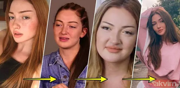 Danla Bilic sonunda bunu da yaptı, estetiğine estetik ekledi! Yüzünde yok yok - 13