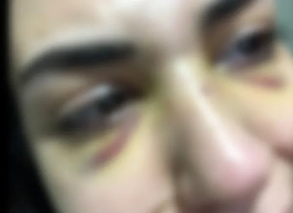 ankarada-24-yasindaki-universite-ogrencisi-aydan-d-eski-erkek-arkadasi-tarafindan-sokak-ortasinda-darbedildi-b-1665064192465.jpg Ankara'da 24 yaşındaki üniversite öğrencisi Aydan D. eski erkek arkadaşı tarafından sokak ortasında darbedildi! 'Beni öldüreceğini söyledi'-7