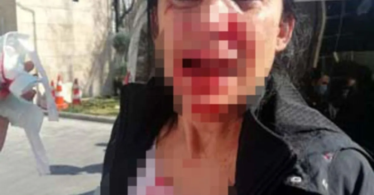 komsularin kavgasi kanli bitti kalemi