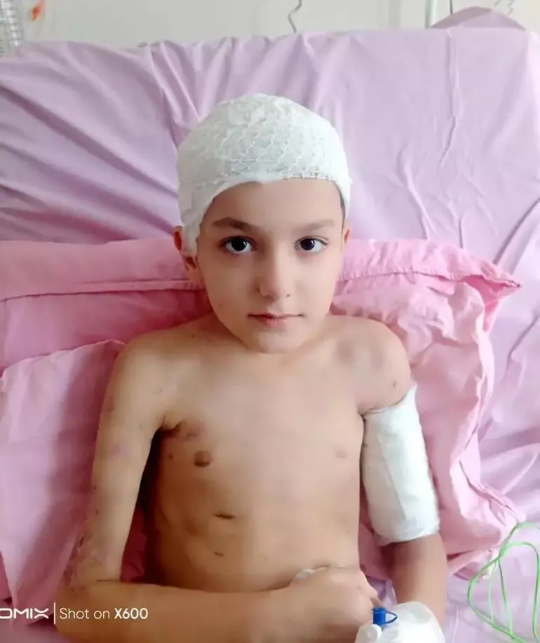 1720607398026.jpeg Başıboş sokak köpeklerinin saldırısına uğrayan Tunahan’ın son hali içler acısı! Eve kapandı herkesten kaçıyor-4