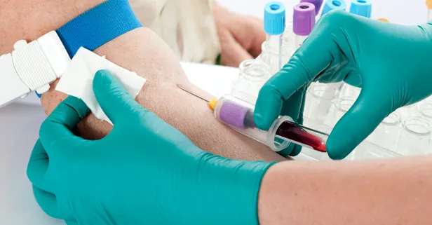 Oruçluyken kan aldırmak orucu bozar mı?