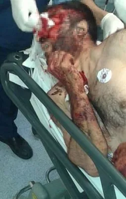 İşte o teröristin son hali!