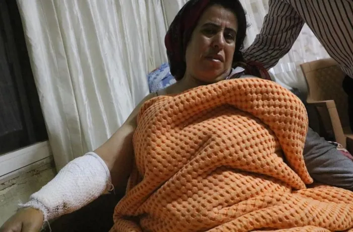 yine-kopek-saldirisi-dogo-argentino-cinsi-kopegin-saldirdigi-kadin-hastaneye-kaldirildi-1703618241646.jpeg Yine köpek saldırısı! Dogo Argentino cinsi köpeğin saldırdığı kadın hastaneye kaldırıldı-6