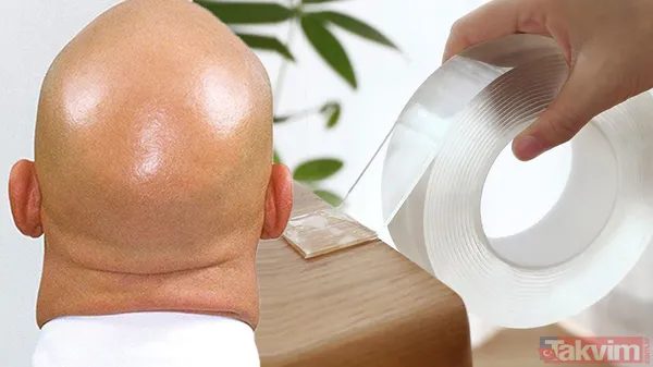 Kelliğin merhemi bulundu 40 yıl düşünsek aklımıza gelmez! Saçı olmayanlar bu haber sizin için müjde ki ne müjde - 1