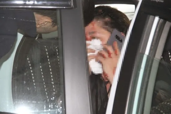 UBER şoförünün kadın yolcuyu darbettiği iddiası-2