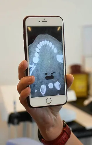 Kokoreçten bir ısırık aldı hayatının şokunu yaşadı! Dilinden ameliyatla alındı...