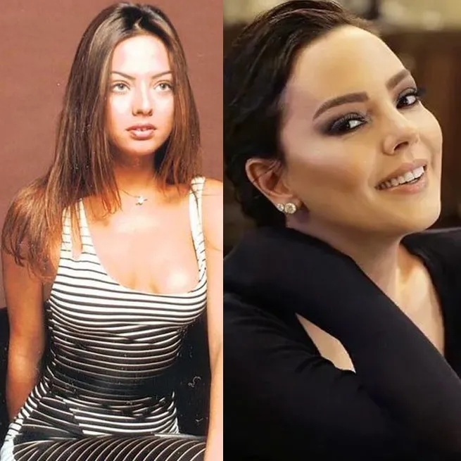 Yüz lifting yaptıran Ebru Yaşar’ın son hali olay oldu: İnsan bunu kendine nasıl yapar? - 7