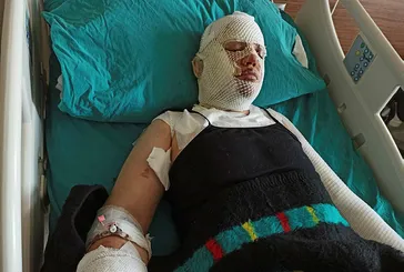 Depremzede eski eşini kaynar suyla yaktı