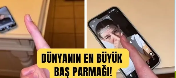 Tiktok fenomeni dünyanın en büyük başparmağına sahip! Bu yüzden telefon bile kullanamıyor