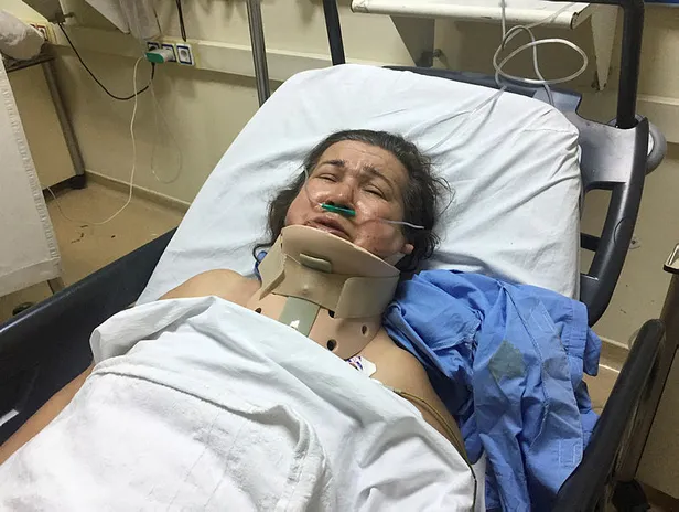 Buse Acar'ın annesi kendine geldi! İlk sözü yürekleri dağladı-1