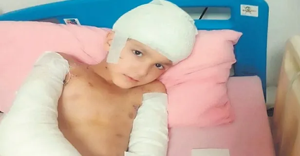 Başıboş köpek saldırısında Ankara'ya rekor tazminat