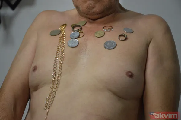 ‘Mıknatıs adam’ Süleyman! Çatal kaşık metal vücuduna yapışıyor! İlçenin en çekici adamı - 1