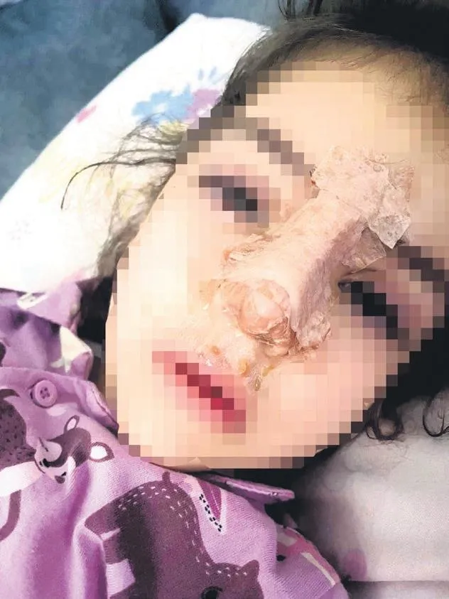 ozel-kreste-4-yasindaki-cocugun-burnu-kirildi-okul-hicbir-sey-olmamis-gibi-davrandi-kamera-kayitlarini-izletme-1701638329472.jpeg Özel kreşte 4 yaşındaki çocuğun burnu kırıldı okul hiçbir şey olmamış gibi davrandı: "Kamera kayıtlarını izletmediler"-3
