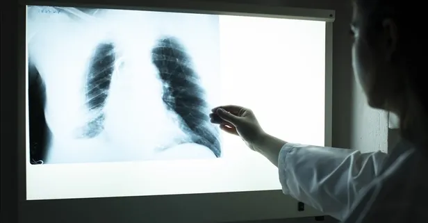 Dünyanın en ölümcül hastalıklarından biri: 10 milyondan fazla kişi yakalanıyor