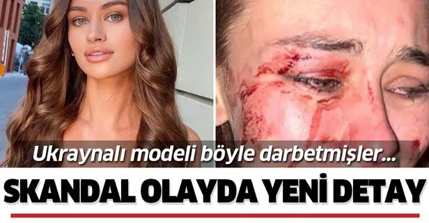 Ukraynalı model Çeşme'de darbedilmişti! Skandal olayda yeni görüntüler
