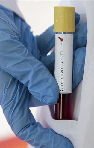 Coronavirüs aşısı için kritik gün: ABD'de ilk kez test edilecek