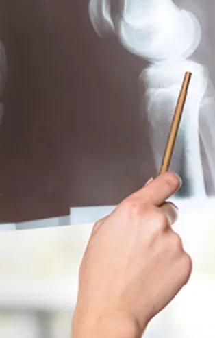 Kemik sağlığı ihmale gelmez