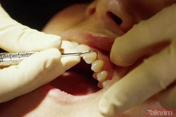 Mide Ağrısı Ve Bulantı: Göz Ardı Edilen Semptomlar Kalp Krizinin Daha Az Bilinen Semptomları Arasında Karın Ağrısı Ve Mide Bulantısı Yer Alıyor. Bu Tür...