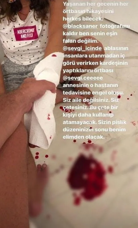 son-dakika-ayrildigi-esi-tarafindan-darbedilen-irem-ay-berkay-saner-icin-uzaklastirma-karari-aldirdi-1643985365721.jpg SON DAKİKA: Ayrıldığı eşi tarafından darbedilen İrem Ay Berkay Saner için uzaklaştırma kararı aldırdı-7