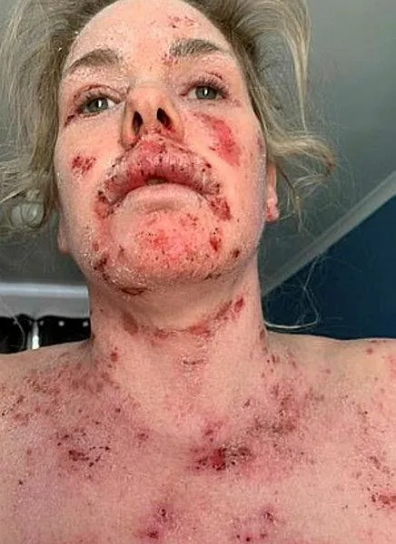 Güney Afrika’da yaşayan Samantha Saunders'ın hayatı bir krem ile değişti! Sebebini öğrenenler şoke oldu-3